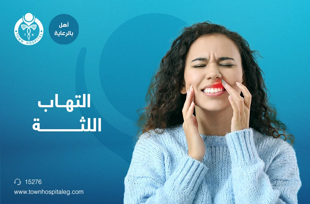 التهاب اللثة