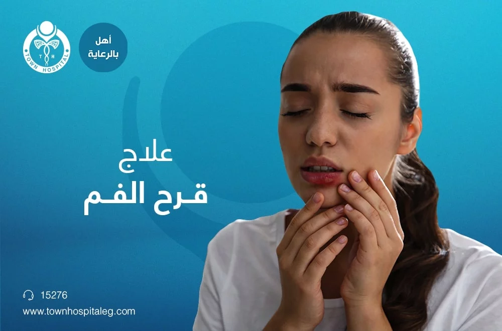علاج قرح الفم