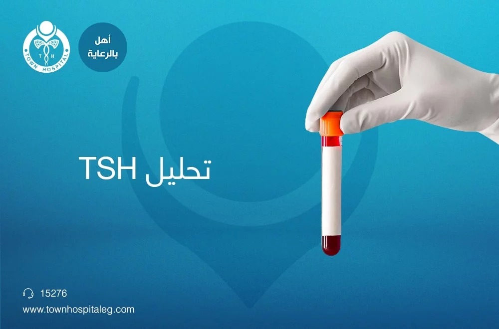 ما هو تحليل TSH؟