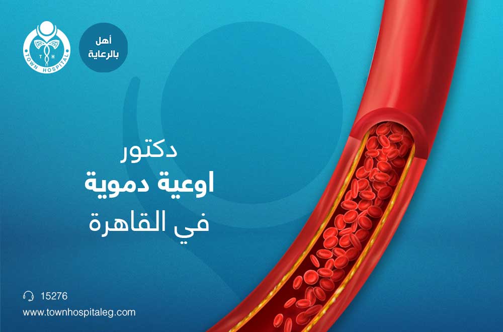دكتور اوعية دموية في القاهرة